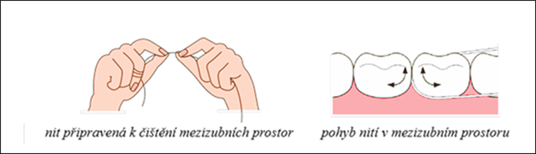 Věděli jste, že i zuby mají svůj svátek? 4 metoda civky