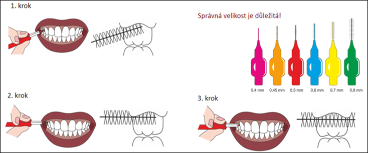 Věděli jste, že i zuby mají svůj svátek? 3 mezizubni kartacek