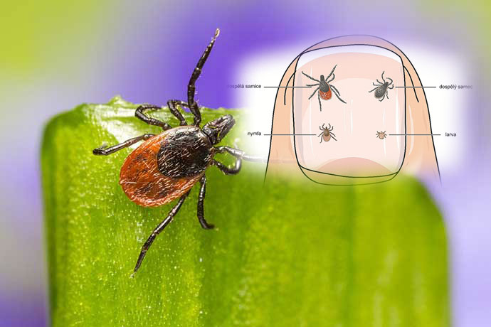 Pozor, klíšťata útočí – Jak se chránit a co dělat při nákaze? 1 kliste uv